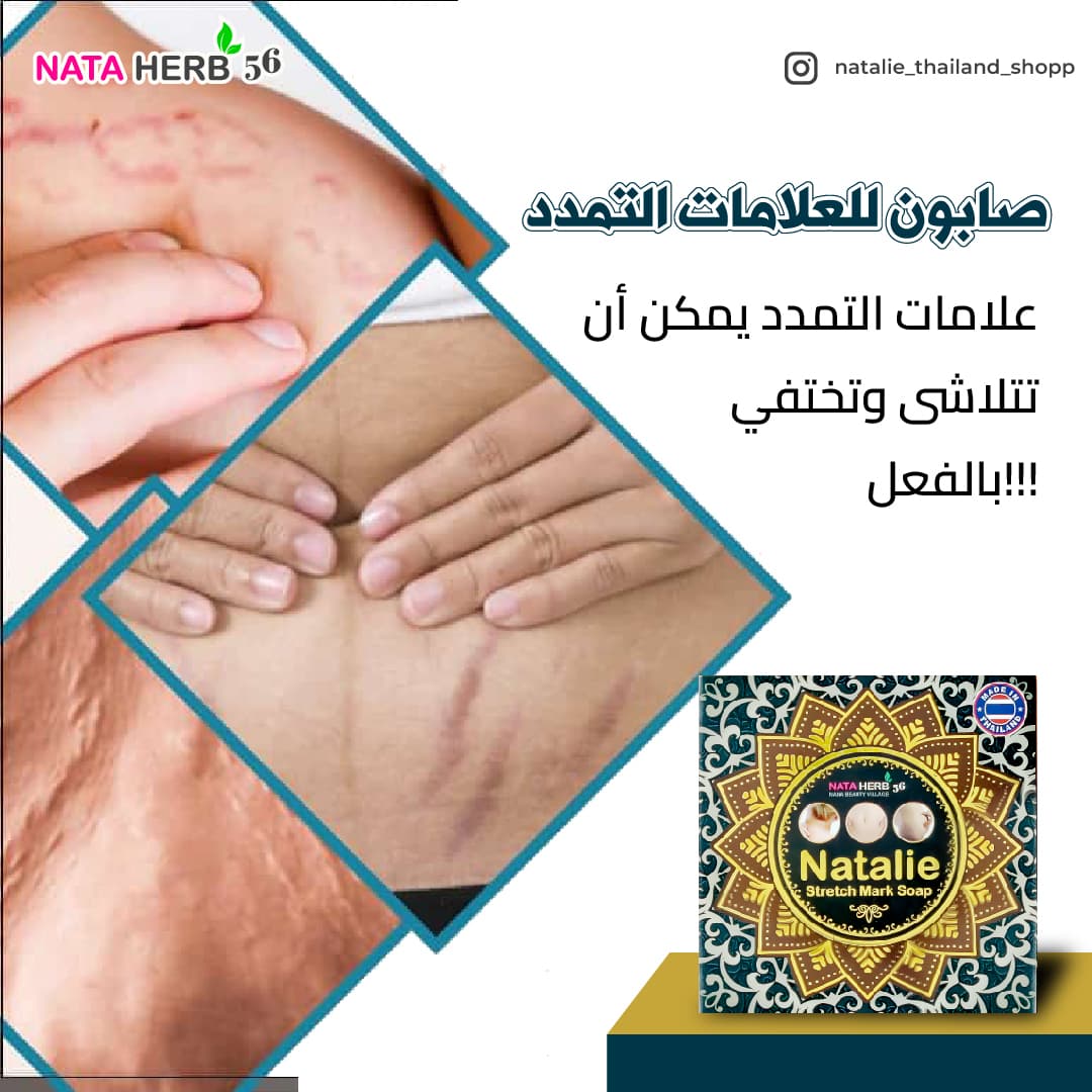 Natalie stretch Mark Soap - ภาพที่ 2
