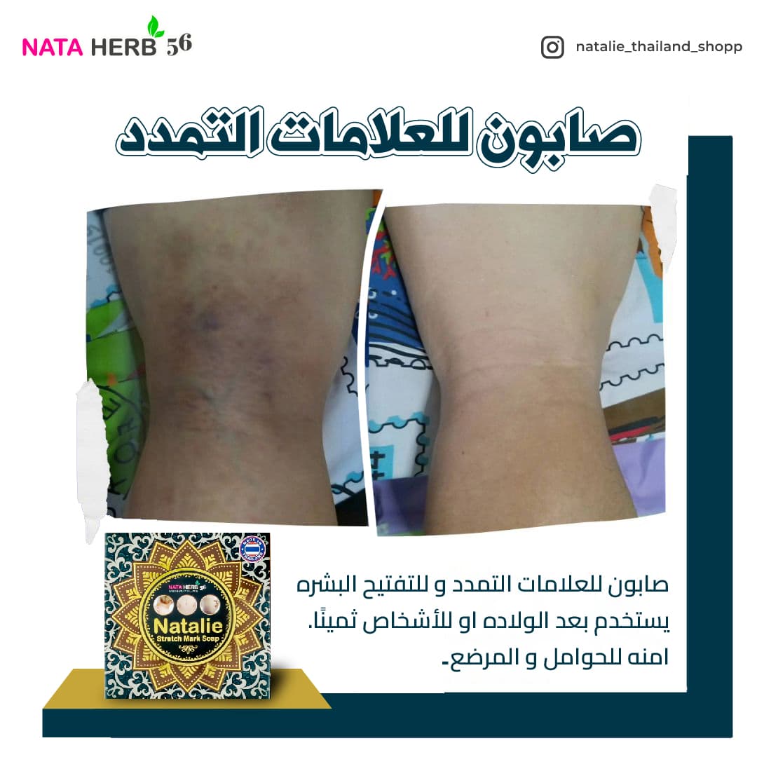 Natalie stretch Mark Soap - ภาพที่ 4