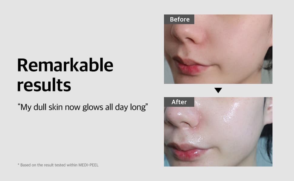 Medi-Peel Bio-Intense glutathione 6000 White Ampoule 30 ml - ภาพที่ 2