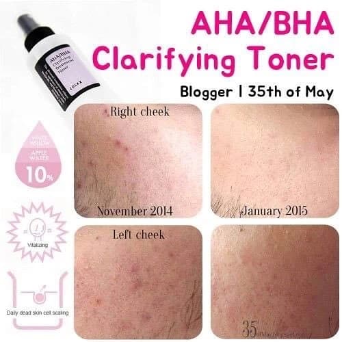 Cosrx AHA-BHA Clarifying Treatment Toner 150ml - ภาพที่ 3